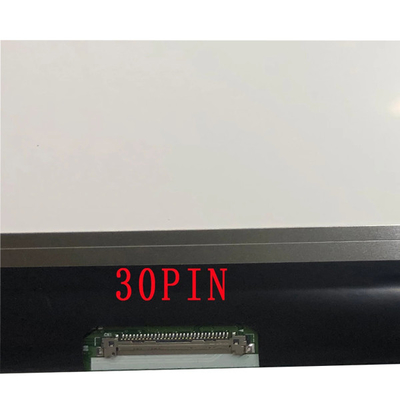 LG Laptop Vervanging 15,6 Duimlcd Laptop het Scherm HOOFDmonitor LP156WF6-SPP2