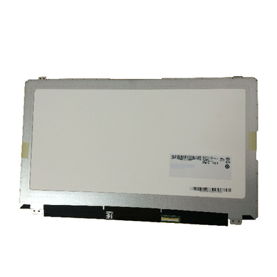 RGB Verticale Streeplaptop 15,6 aanraking LCD 1366*7638 40pin B156XTT01.2