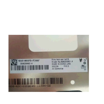 RGB Verticale LCD van Streepb080ean01.4   800*1280 31 spelden SCHERM